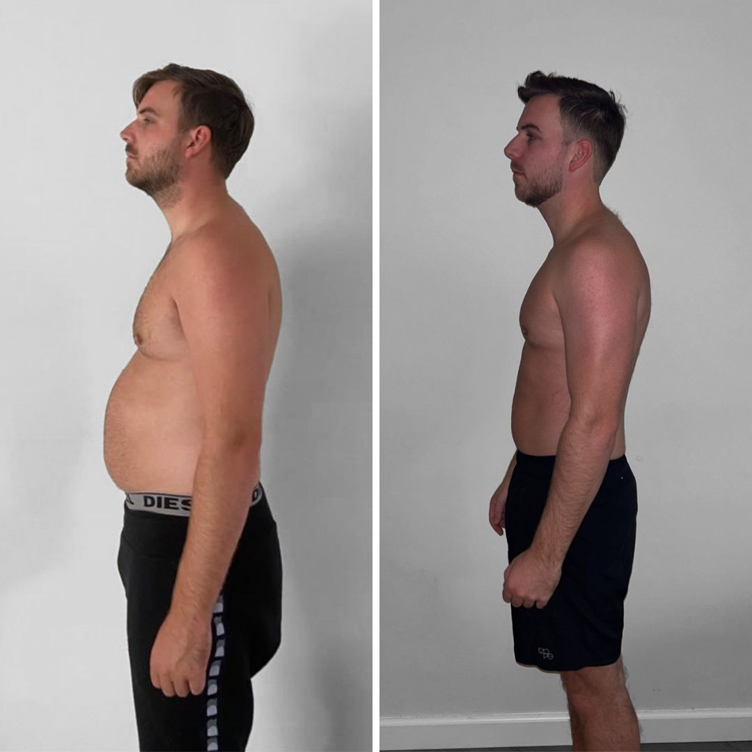 Seitenansicht desselben Mannes vor und nach dem Gewichtsverlust, mit einem deutlich flacheren Bauch und schlankerem Aussehen nach der Veränderung.