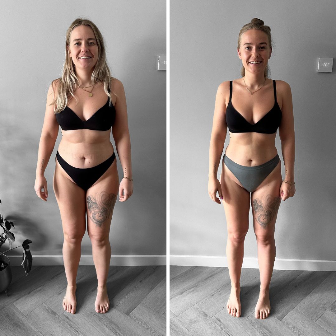 Vorher-Nachher-Foto einer Frau in schwarzer und grauer Unterwäsche, stehend vor einer grauen Wand, mit einer Tätowierung am rechten Oberschenkel.